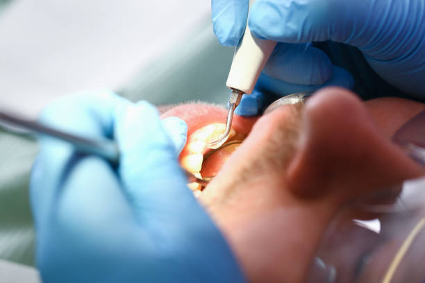 Best Broken Tooth Emergency  in Centerville, PA